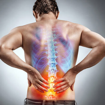 Sciatica Treatment in Alpharetta, GA