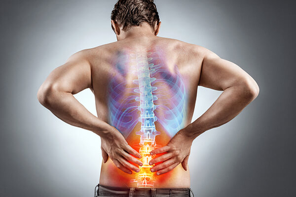 Sciatica Treatment in Alpharetta, GA